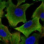 ALDH1A1 Polyclonal Antibody