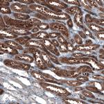 ALDH1A1 Antibody in Immunohistochemistry (Paraffin) (IHC (P))
