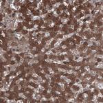 ALDH1A1 Antibody in Immunohistochemistry (Paraffin) (IHC (P))