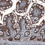 ALDH1A1 Antibody in Immunohistochemistry (Paraffin) (IHC (P))