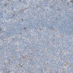 ALDH1A1 Antibody in Immunohistochemistry (Paraffin) (IHC (P))