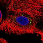 Transthyretin Polyclonal Antibody