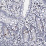 Aurora A Antibody in Immunohistochemistry (Paraffin) (IHC (P))