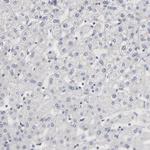 Aurora A Antibody in Immunohistochemistry (Paraffin) (IHC (P))