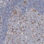 Aurora A Antibody in Immunohistochemistry (Paraffin) (IHC (P))