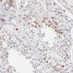 Aurora A Antibody in Immunohistochemistry (Paraffin) (IHC (P))
