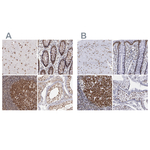 TRF2 Polyclonal Antibody