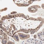 Survivin Antibody in Immunohistochemistry (Paraffin) (IHC (P))