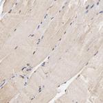 Survivin Antibody in Immunohistochemistry (Paraffin) (IHC (P))