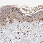 Survivin Antibody in Immunohistochemistry (Paraffin) (IHC (P))