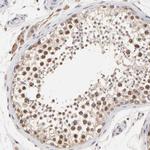 Survivin Antibody in Immunohistochemistry (Paraffin) (IHC (P))