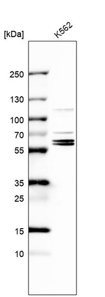TROVE2 Antibody in Western Blot (WB)