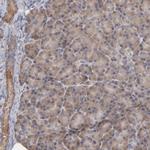 STS Antibody in Immunohistochemistry (Paraffin) (IHC (P))