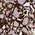 STS Antibody in Immunohistochemistry (Paraffin) (IHC (P))
