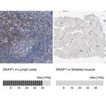 SKAP55 Antibody in Immunohistochemistry (Paraffin) (IHC (P))