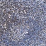 SKAP55 Antibody in Immunohistochemistry (Paraffin) (IHC (P))