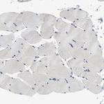 SKAP55 Antibody in Immunohistochemistry (Paraffin) (IHC (P))
