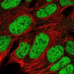 ROC1 Antibody in Immunocytochemistry (ICC/IF)