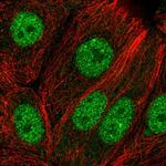 EFCAB6 Polyclonal Antibody