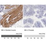 Myoglobin Polyclonal Antibody