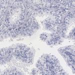 Myoglobin Antibody in Immunohistochemistry (Paraffin) (IHC (P))