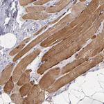 Myoglobin Antibody in Immunohistochemistry (Paraffin) (IHC (P))
