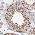 NSF Antibody in Immunohistochemistry (Paraffin) (IHC (P))