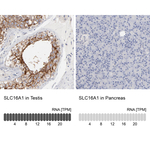 MCT1 Antibody in Immunohistochemistry (Paraffin) (IHC (P))