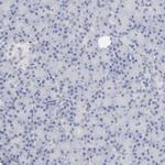 MCT1 Antibody in Immunohistochemistry (Paraffin) (IHC (P))