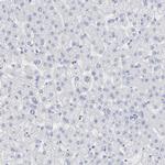 P2Y8 Antibody in Immunohistochemistry (Paraffin) (IHC (P))