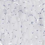 P2Y8 Antibody in Immunohistochemistry (Paraffin) (IHC (P))