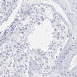 P2Y8 Antibody in Immunohistochemistry (Paraffin) (IHC (P))