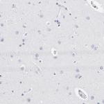 CD180 Antibody in Immunohistochemistry (Paraffin) (IHC (P))