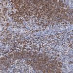 CD180 Antibody in Immunohistochemistry (Paraffin) (IHC (P))