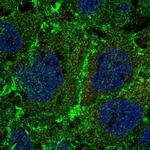 PTPRM Polyclonal Antibody