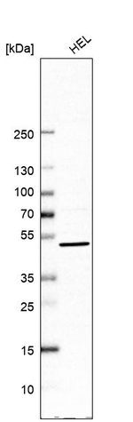 UBP1 Antibody in Western Blot (WB)