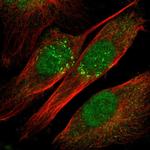 IL-18 Polyclonal Antibody