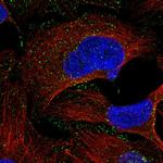 RAB5C Polyclonal Antibody