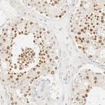 KIF2A Antibody in Immunohistochemistry (Paraffin) (IHC (P))