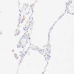 CD11c Antibody in Immunohistochemistry (Paraffin) (IHC (P))