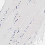 CD11c Antibody in Immunohistochemistry (Paraffin) (IHC (P))