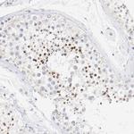 CD11c Antibody in Immunohistochemistry (Paraffin) (IHC (P))