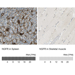 NGFR Antibody in Immunohistochemistry (Paraffin) (IHC (P))