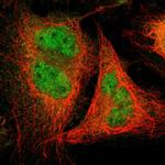 USP13 Polyclonal Antibody