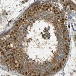 USP13 Antibody in Immunohistochemistry (Paraffin) (IHC (P))