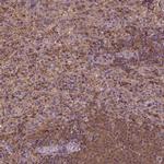 MATK Polyclonal Antibody