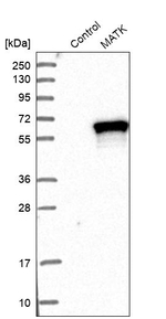 MATK Antibody in Western Blot (WB)