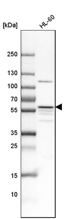 MATK Antibody in Western Blot (WB)