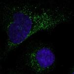 MMP1 Polyclonal Antibody