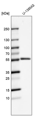 MMP1 Antibody in Western Blot (WB)